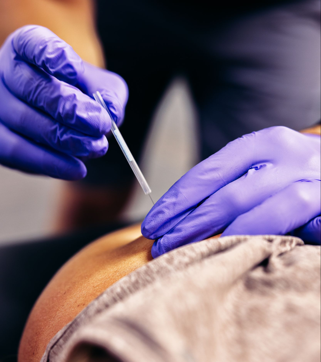 Dry Needling Wilmington
